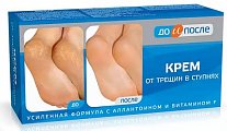 До и После крем от трещин в ступнях, 50мл